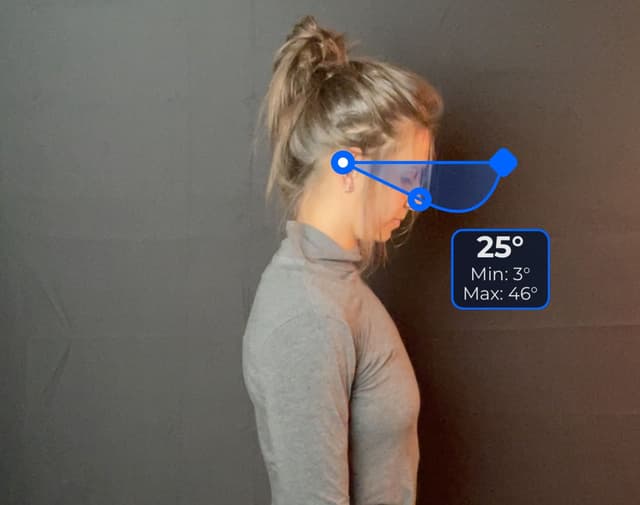 Side view of patient, standing, demonstrating the flexion movement. Visual overlay shows a 25 degree angle measurement.