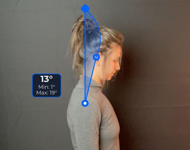 Side view of patient, standing, demonstrating the flexion movement. Visual overlay shows a 13 degree angle measurement.