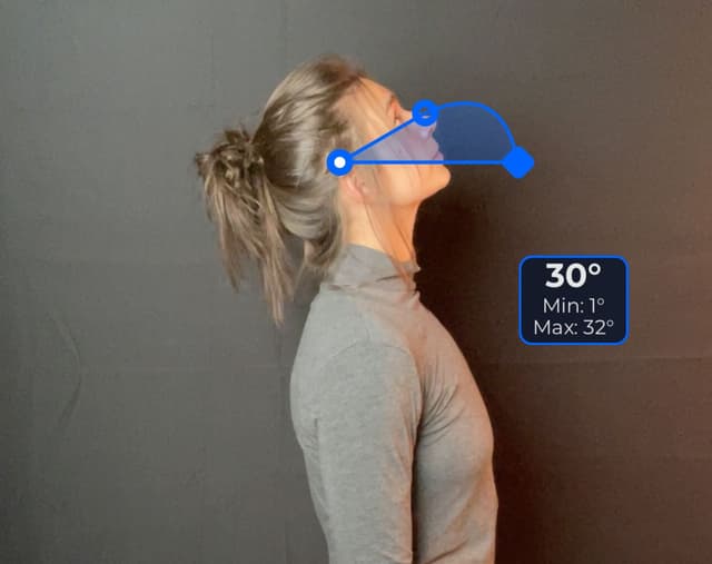 Side view of patient, standing, demonstrating the extension movement. Visual overlay shows a 30 degree angle measurement.