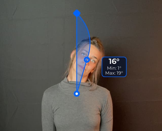 Front view of patient, standing, demonstrating the lateral flexion movement, head tilt to the left. Visual overlay shows a 16 degree angle measurement.