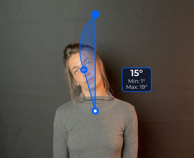 Front view of patient, standing, demonstrating the lateral flexion movement, head tilt to the right. Visual overlay shows a 15 degree angle measurement.