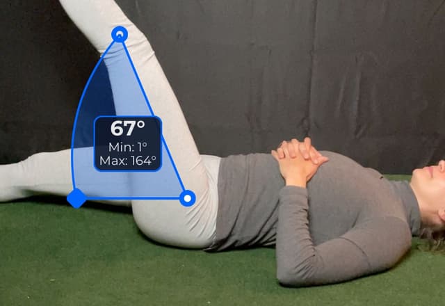 Side view of patient, supine, demonstrating the straight leg test movement. Visual overlay shows a 67 degree angle measurement.