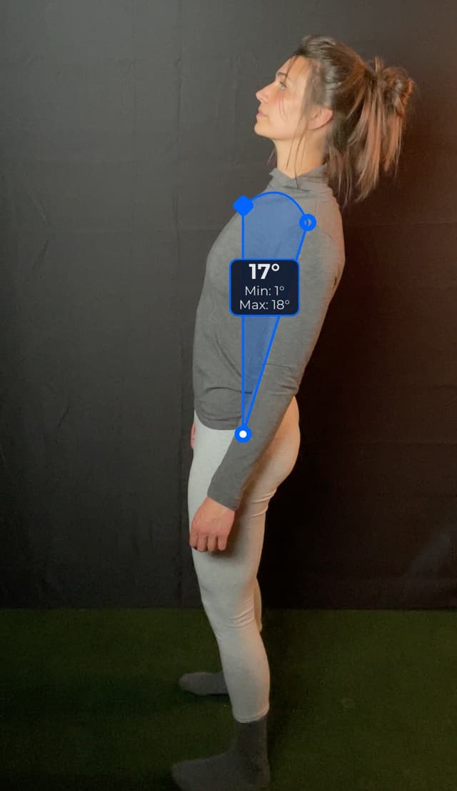 Side view of patient, standing, demonstrating the flexion extension movement, leaning backward. Visual overlay shows a 17 degree angle measurement.