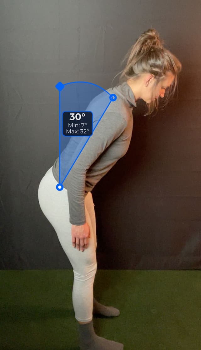 Side view of patient, standing, demonstrating the flexion extension movement, leaning backward. Visual overlay shows a 30 degree angle measurement.