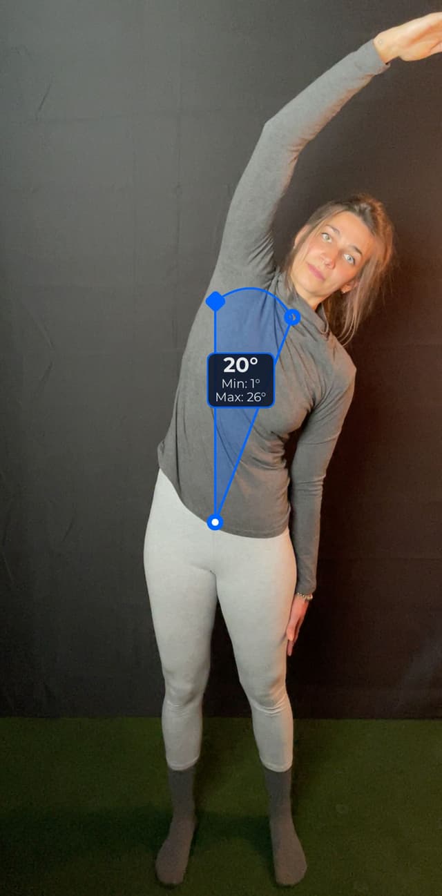 Front view of patient, standing, demonstrating the left/right side bend movement, leaning to the left. Visual overlay shows a 20 degree angle measurement.