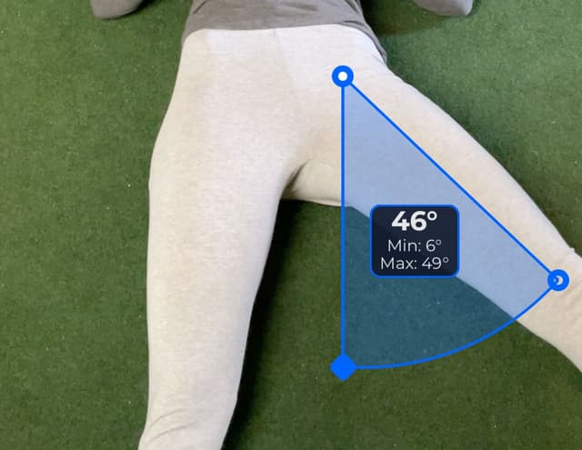 Front view of patient, supine, demonstrating the abduction / adduction movement. Visual overlay shows a 46 degree angle measurement.