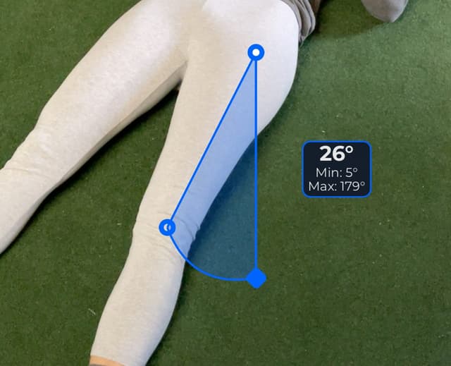 Front view of patient, supine, demonstrating the abduction / adduction movement. Visual overlay shows a 26 degree angle measurement.