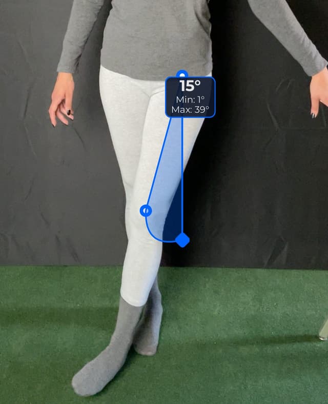 Front view of patient, standing, demonstrating the abduction / adduction movement. Visual overlay shows a 15 degree angle measurement.