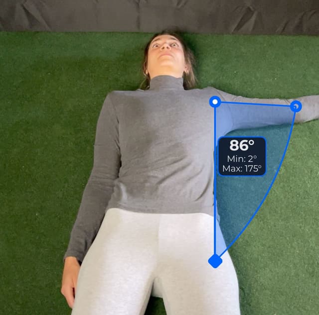 Aerial view of patient, supine, demonstrating the abduction/adduction movement. Visual overlay shows an 86 degree angle measurement.