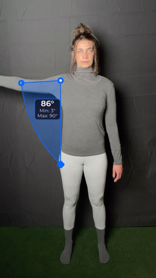 Front view of patient, standing, demonstrating the abduction/adduction movement. Visual overlay shows an 86 degree angle measurement.